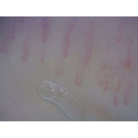 Dino-Lite Microscope numérique CapillaryScope 200 Pro (MEDL4N Pro)