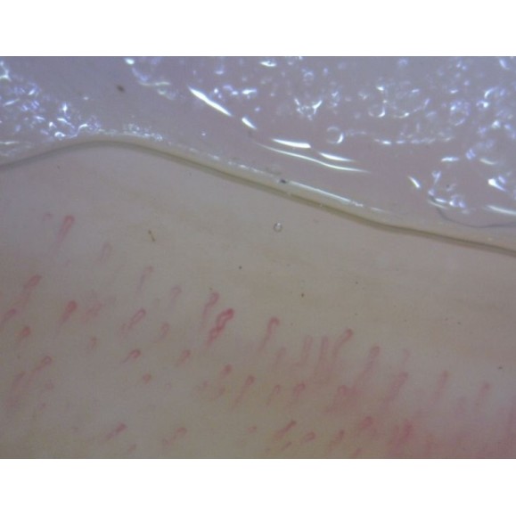 Dino-Lite Microscope numérique CapillaryScope 200 Pro (MEDL4N Pro)