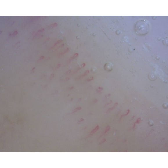 Dino-Lite Microscope numérique CapillaryScope 200 Pro (MEDL4N Pro)