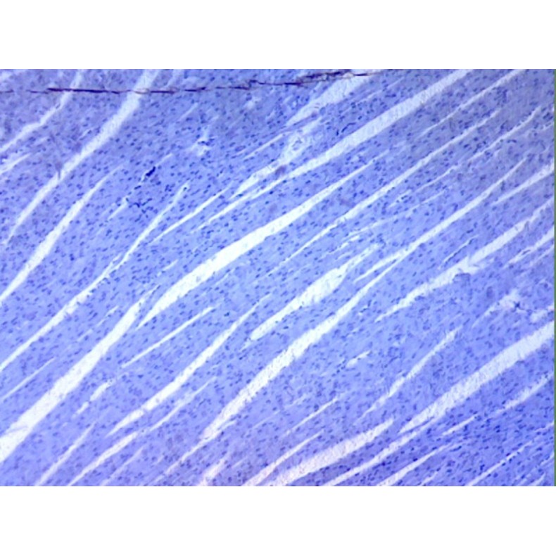 Caja de preparaciones 100 unidades