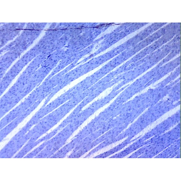 Caja de preparaciones 100 unidades