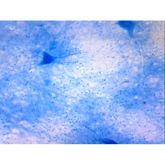 Caja de preparaciones 100 unidades