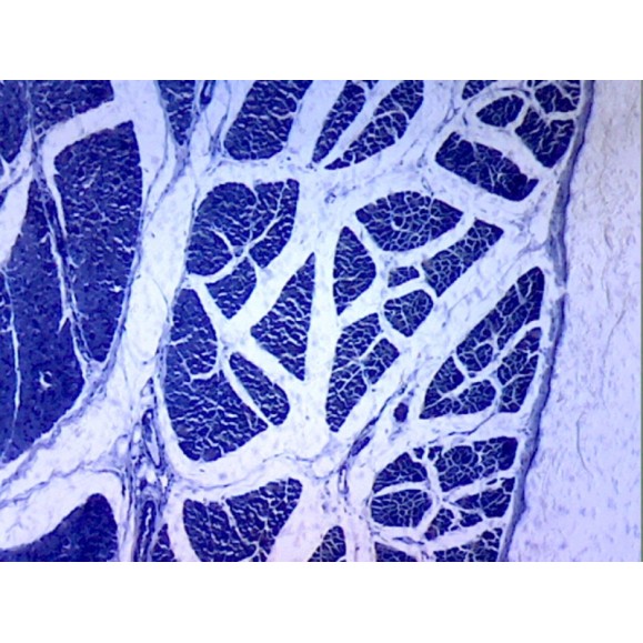 Caja de preparaciones 100 unidades