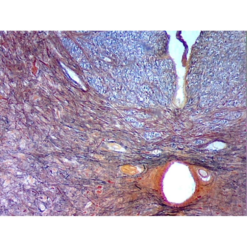 Caja de preparaciones 100 unidades